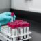 How new blood test could reveal cancer long before symptoms appear – Firstpost