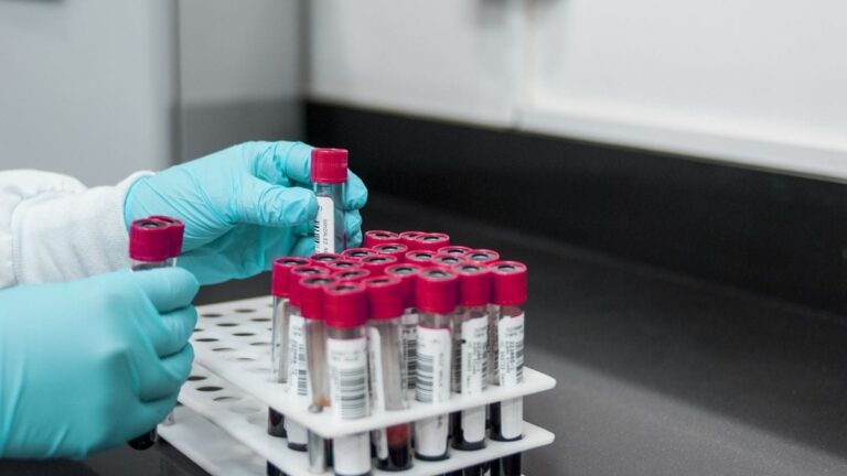 How new blood test could reveal cancer long before symptoms appear – Firstpost