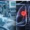 Choking before 30? 1 in 3 Delhi youth show lung abnormalities: Report – Firstpost