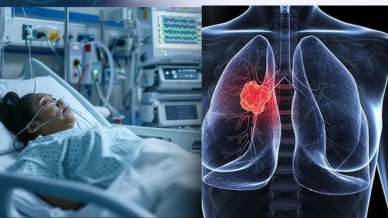 Choking before 30? 1 in 3 Delhi youth show lung abnormalities: Report – Firstpost