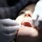 How scientists have used urine to make dental implants – Firstpost