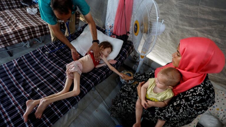 What happens to the human body without food? – Firstpost